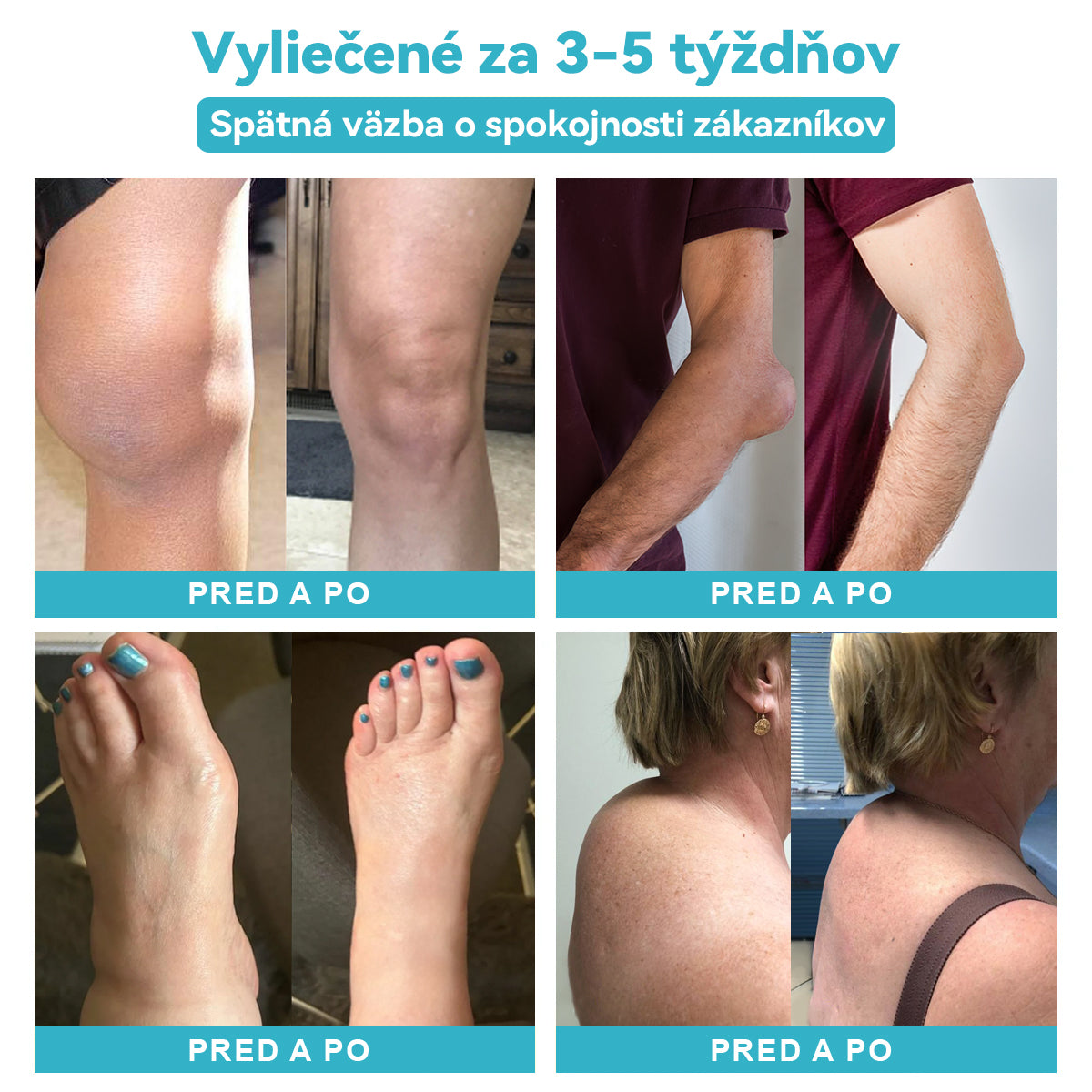 【Platba na dobierku】𝐏𝐚𝐢𝐧𝐌𝐚𝐠™ Lotion na úľavu od nervovej bolesti (🔥bmedzená zľava na čas: Posledných 30 minút🔥)