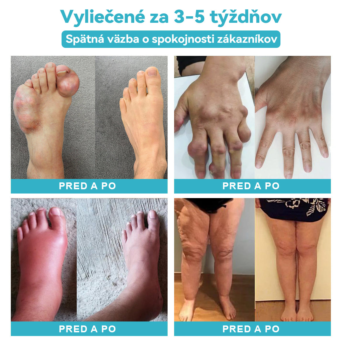 【Platba na dobierku】𝐏𝐚𝐢𝐧𝐌𝐚𝐠™ Lotion na úľavu od nervovej bolesti (🔥bmedzená zľava na čas: Posledných 30 minút🔥)